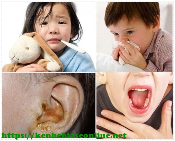 viêm tai, mũi, họng ở trẻ em